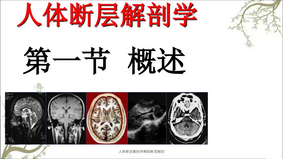 人体断层解剖学胸部断层解剖_第3页