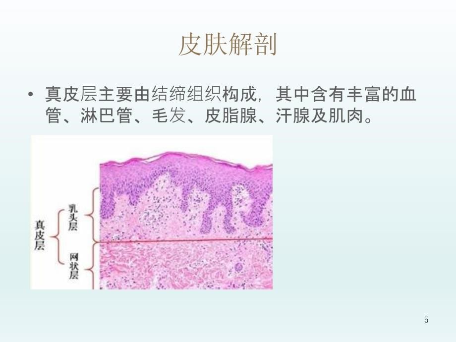 皮肤疾病的超声诊断ppt课件_第5页