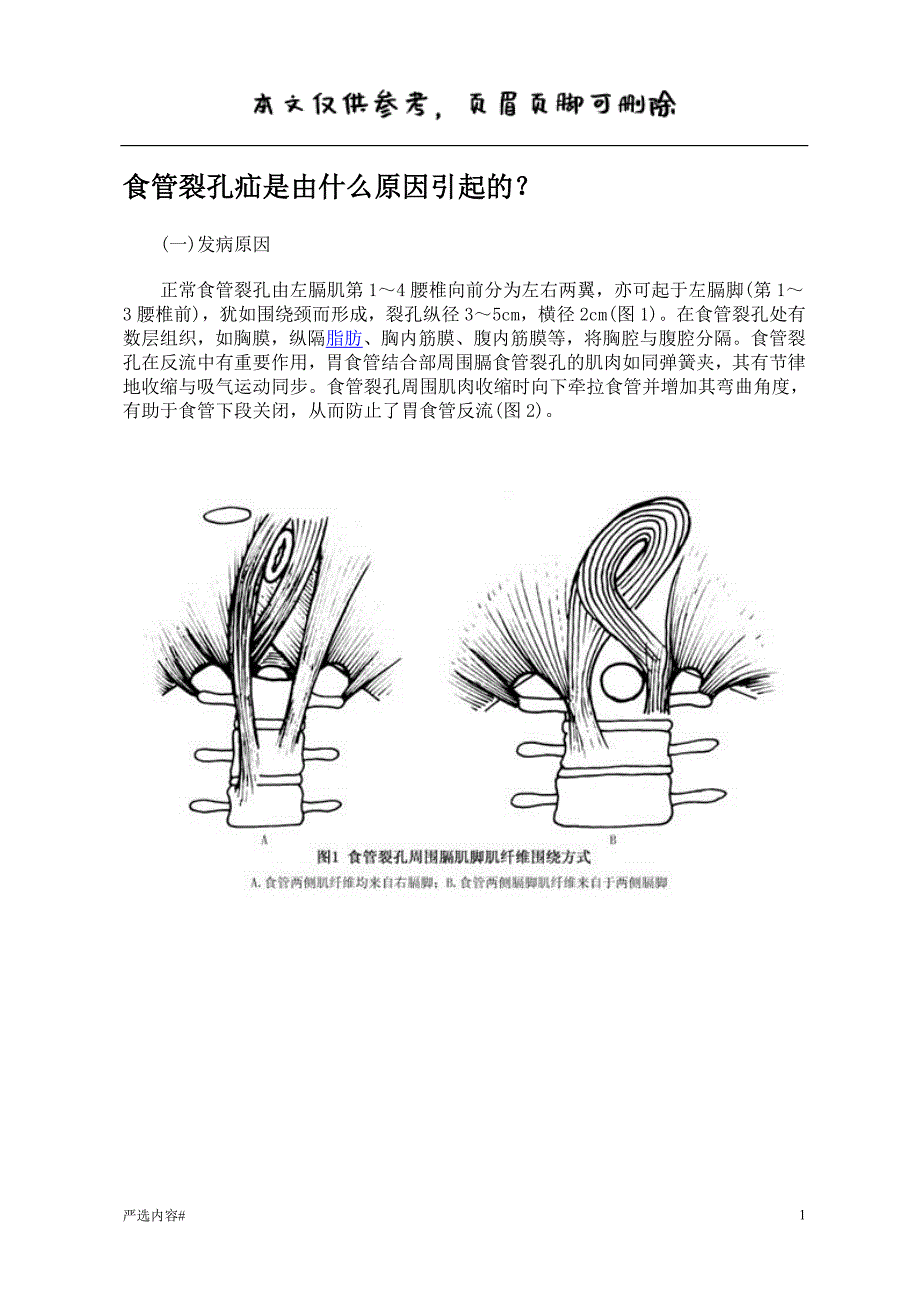 食管裂孔疝是由什么原因引起的参考资料_第1页