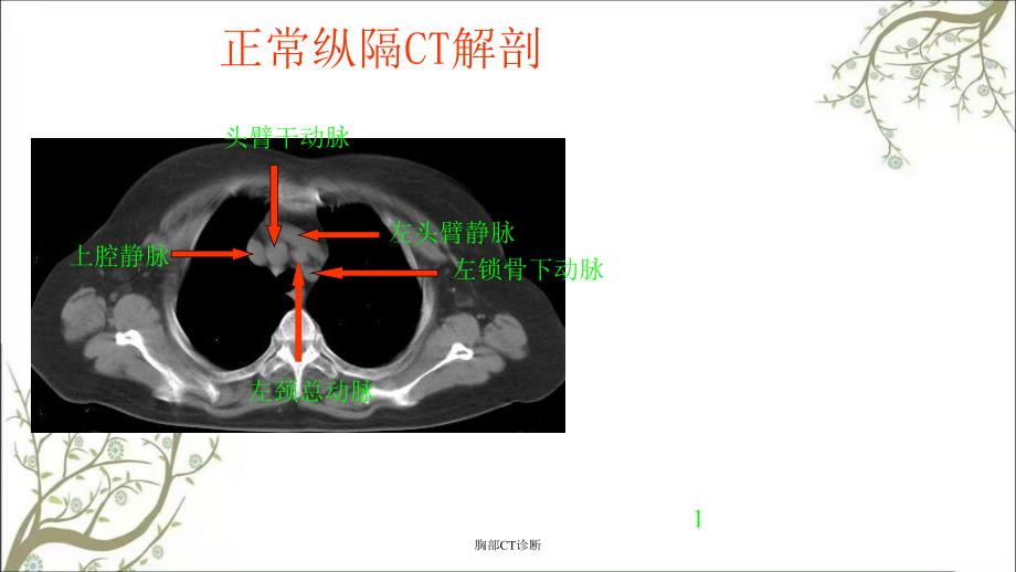 胸部CT诊断课件_第3页