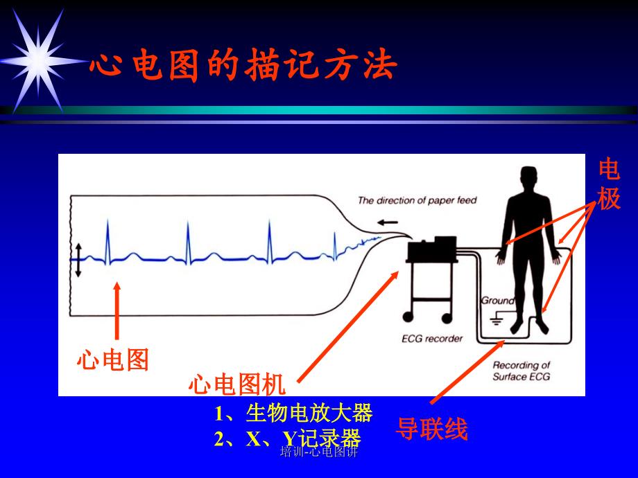 培训心电图讲课件_第4页