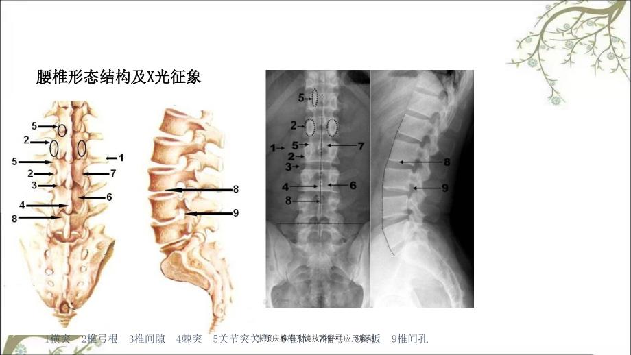 张照庆椎间孔镜技术脊柱应用解剖_第4页