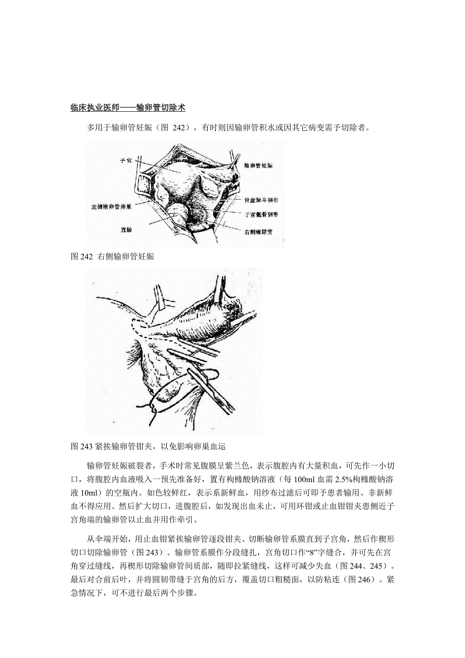 临床执业医师——输卵管切除术_第1页