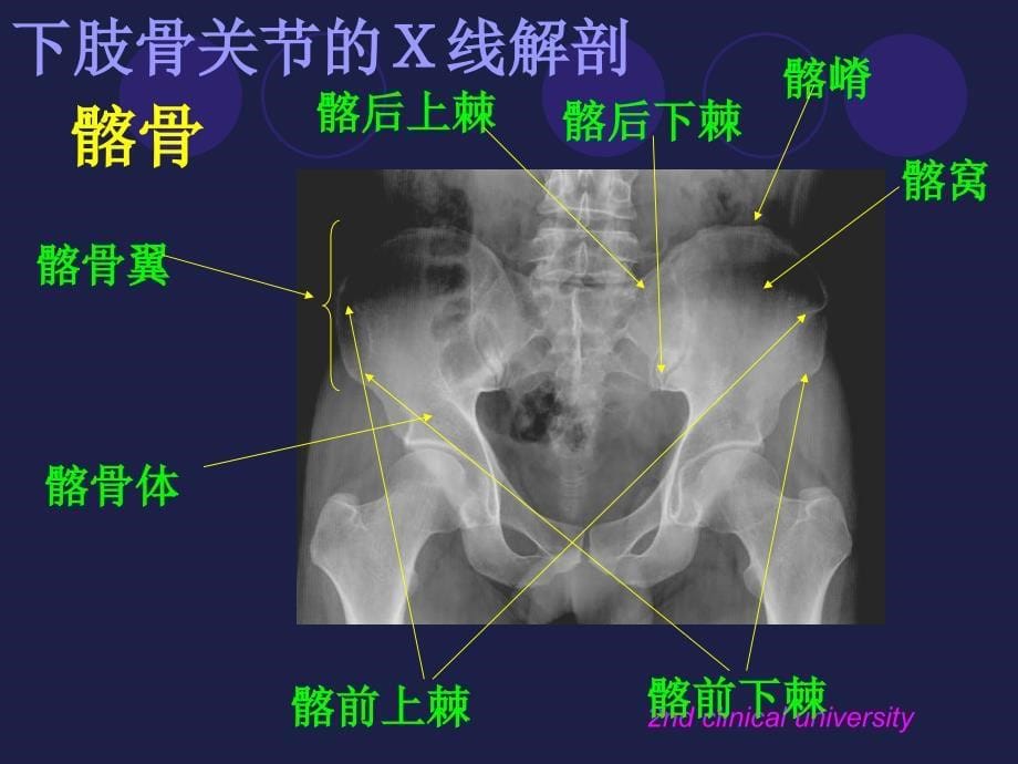 下肢骨影像解剖学.ppt_第5页