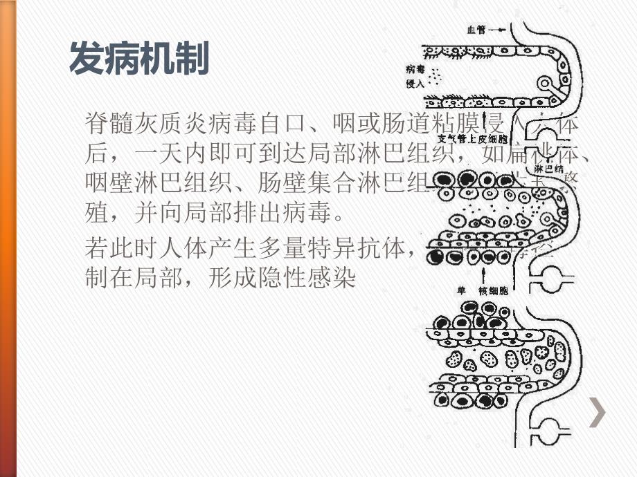 脊髓灰质炎病因PPT课件_第4页