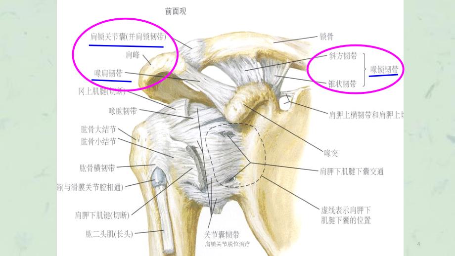 肩锁关节脱位治疗课件_第4页