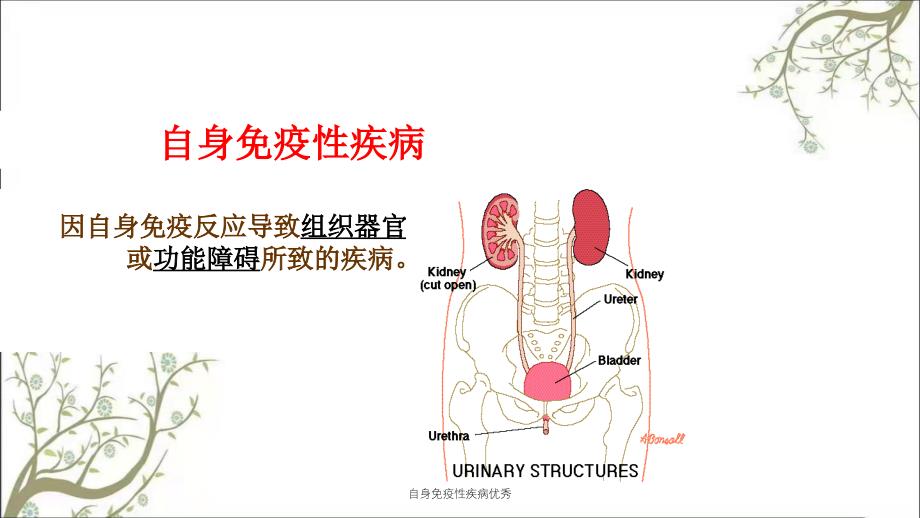 自身免疫性疾病优秀_第3页