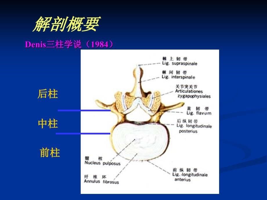 脊柱骨折讲ppt课件_第5页