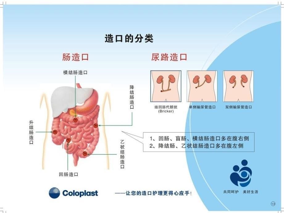 造口病人健康教育_第5页