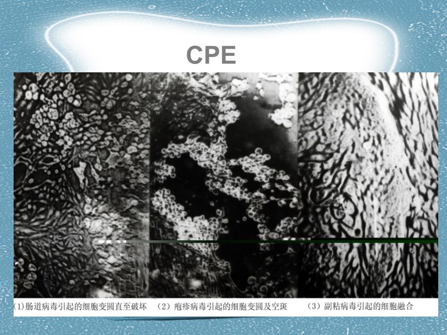 医学微生物学：病毒的感染与免疫_第4页