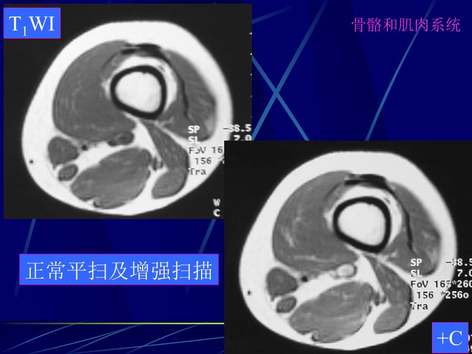 MRI骨骼和肌肉系统-影像FTP_第4页