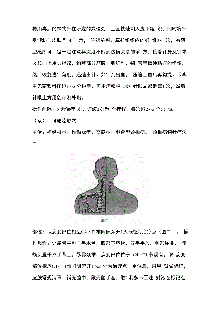 颈椎病钩针疗法_第2页