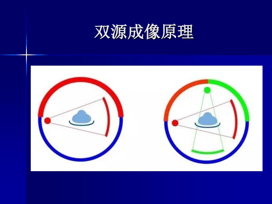 双源CT对痛风石的诊断意义课件_第2页