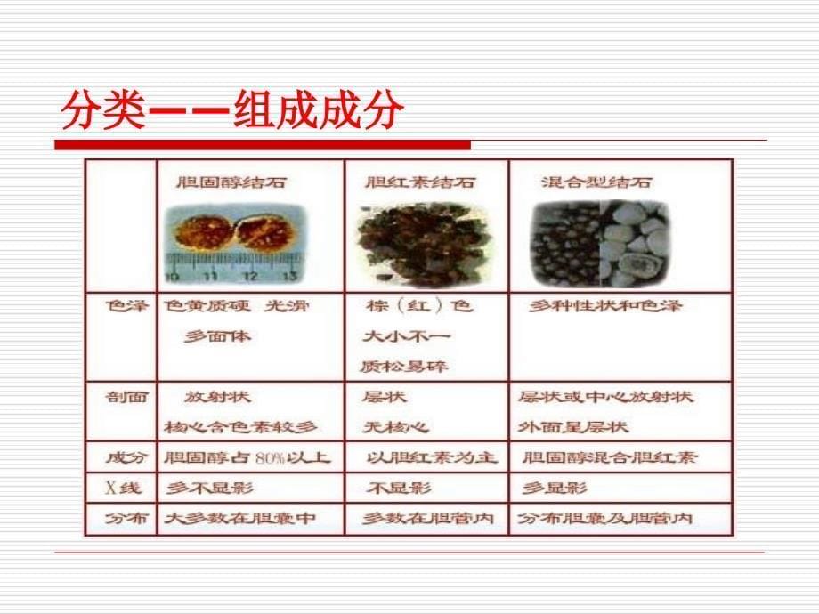 胆囊结石病人围手术期的护理文档资料_第5页