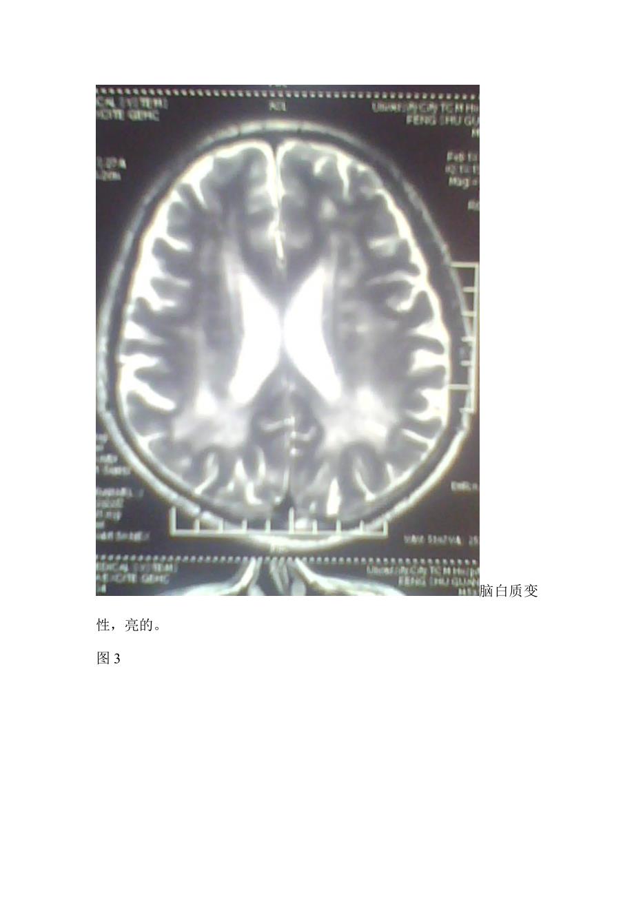 怎么看头颅核磁共振.doc_第4页