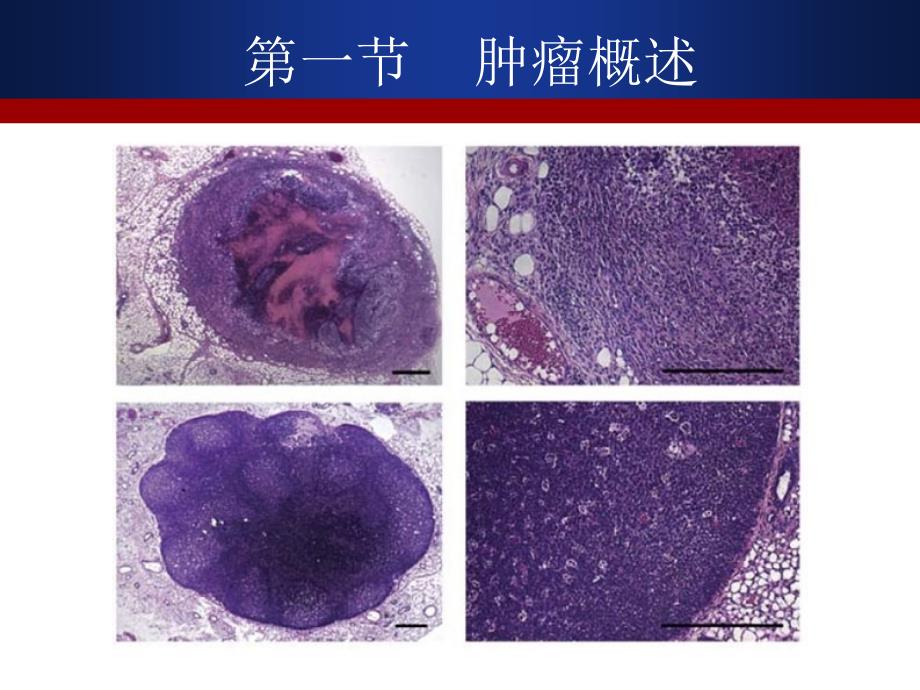 抗肿瘤药物PPT课件_第2页