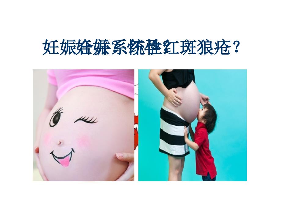 SLE妊娠合并系统性红斑狼疮的护理_第2页