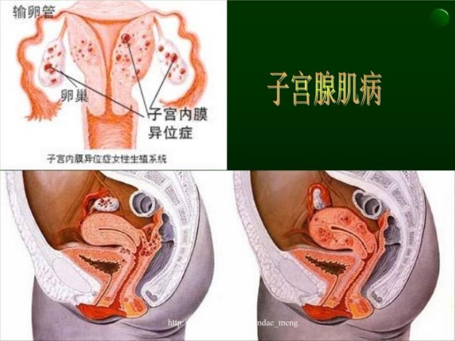 最新妇科护理查房PPT课件_第3页