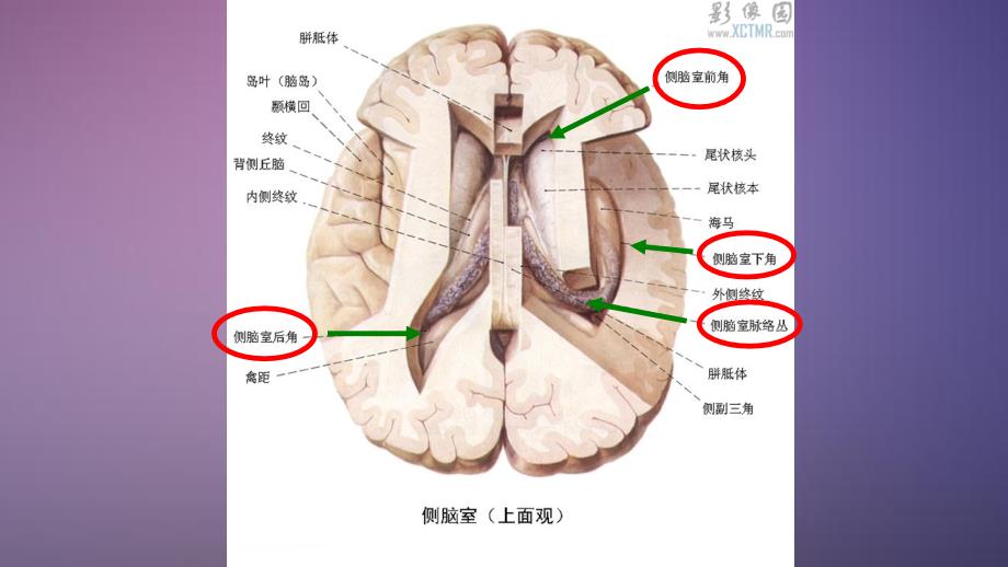 脑室系统解剖干货分享_第4页