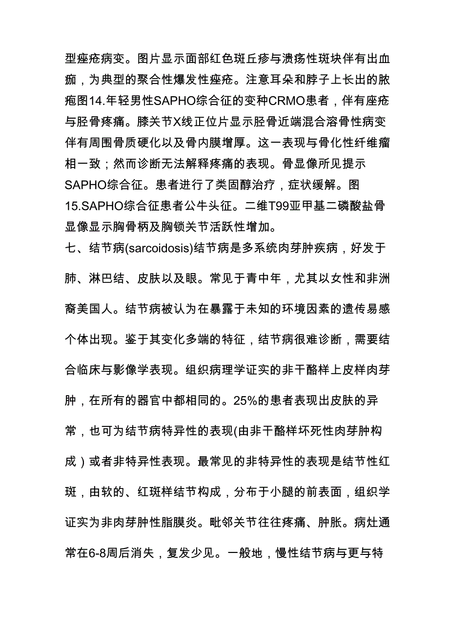 15种累及骨骼与皮肤综合征你知道几种_第3页