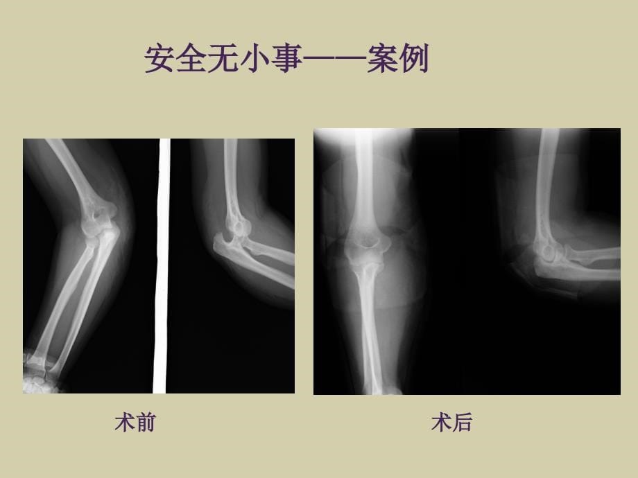 工厂急救知识讲座精选幻灯片_第5页