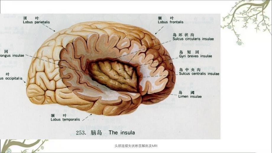 头部连续矢状断层解剖及MRI_第5页