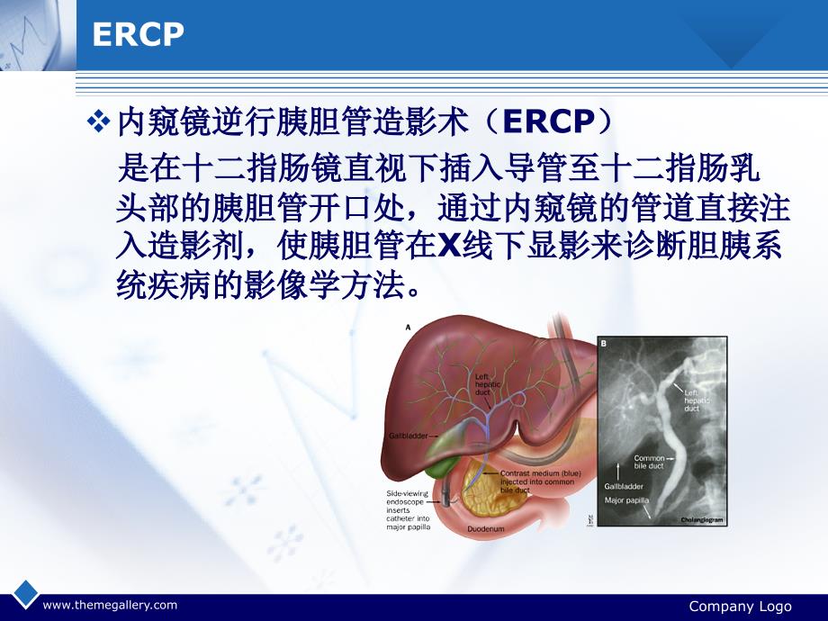 ercp诊疗与并发症ppt课件_第2页