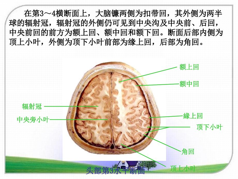 头颈断面解剖学课件_第3页