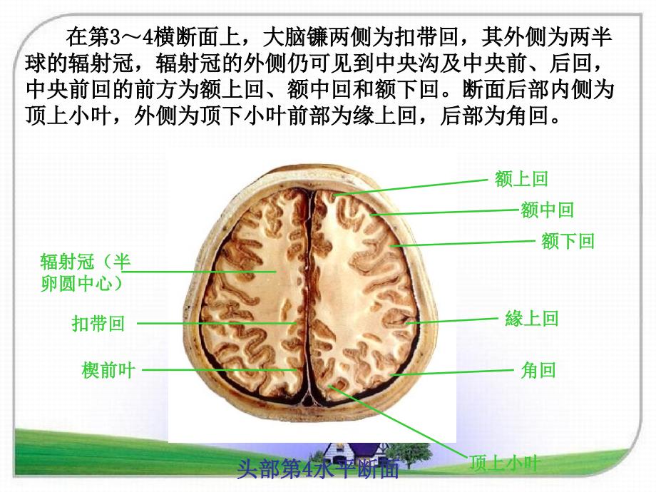 头颈断面解剖学课件_第4页