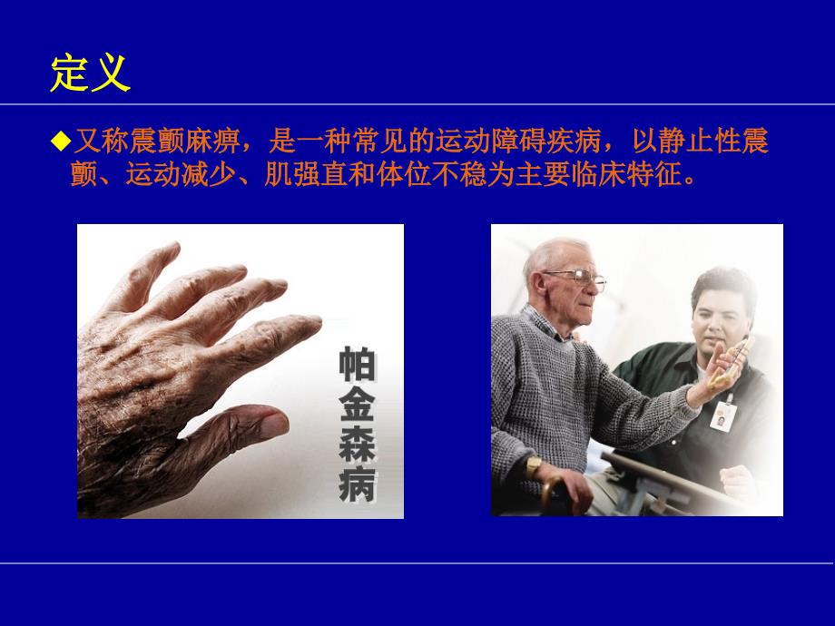 帕金森病的护理问题及措施.ppt_第2页