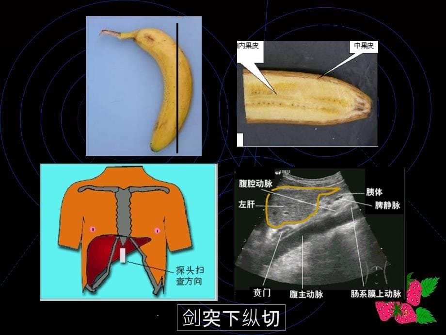 腹部超声诊断PPT课件_第5页