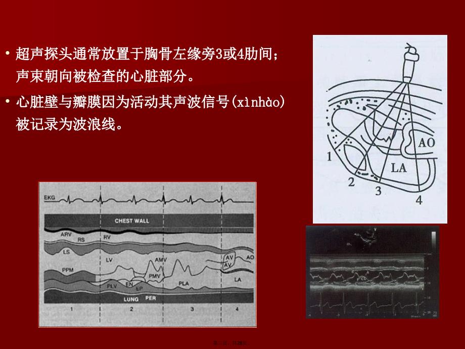 如何解读超声心动图教学文案_第3页