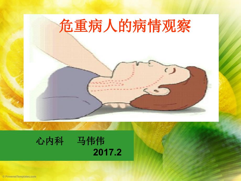 危重病人病情观察【专业研究】_第1页