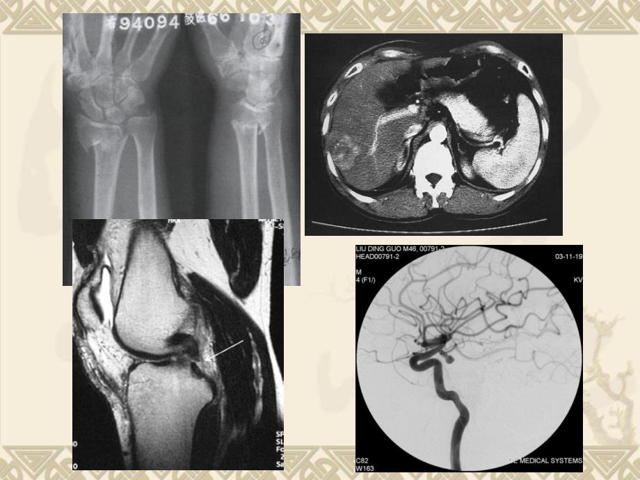 医学影像X线CTMRI_第2页