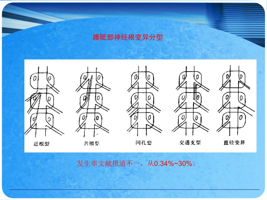 侧路椎间孔镜治疗L5S1椎间盘突出的经验分享ppt课件_第4页