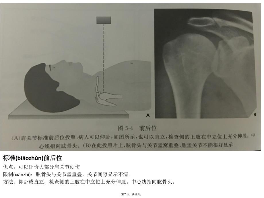 不同肩关节X线投照位资料_第2页