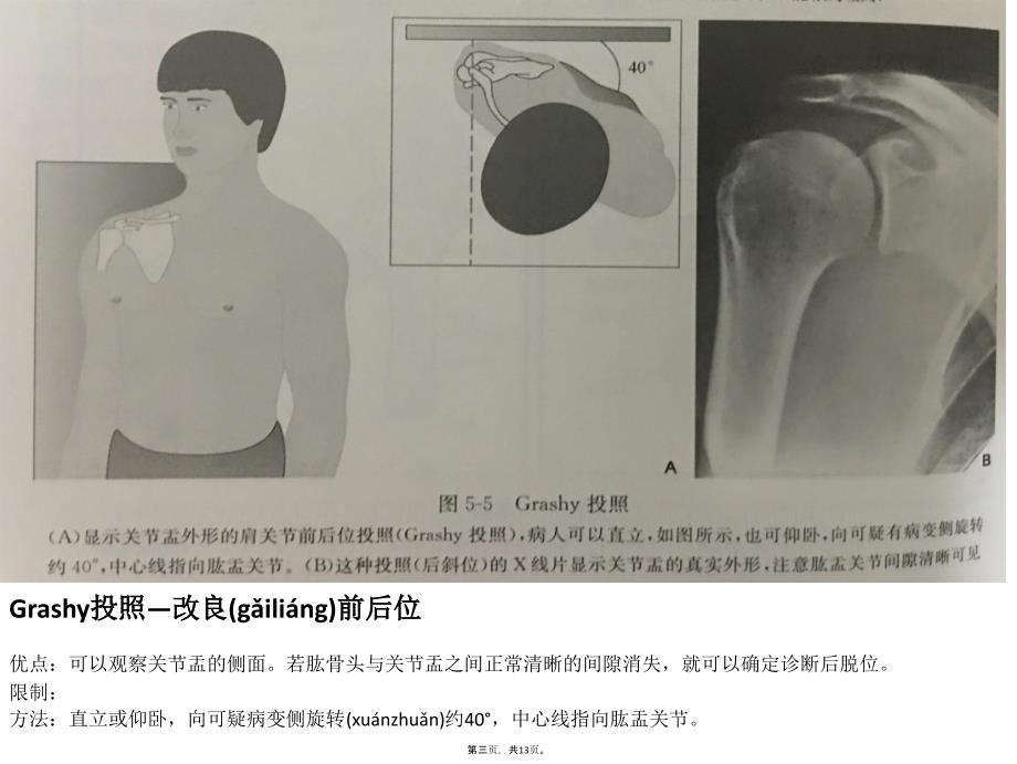 不同肩关节X线投照位资料_第3页