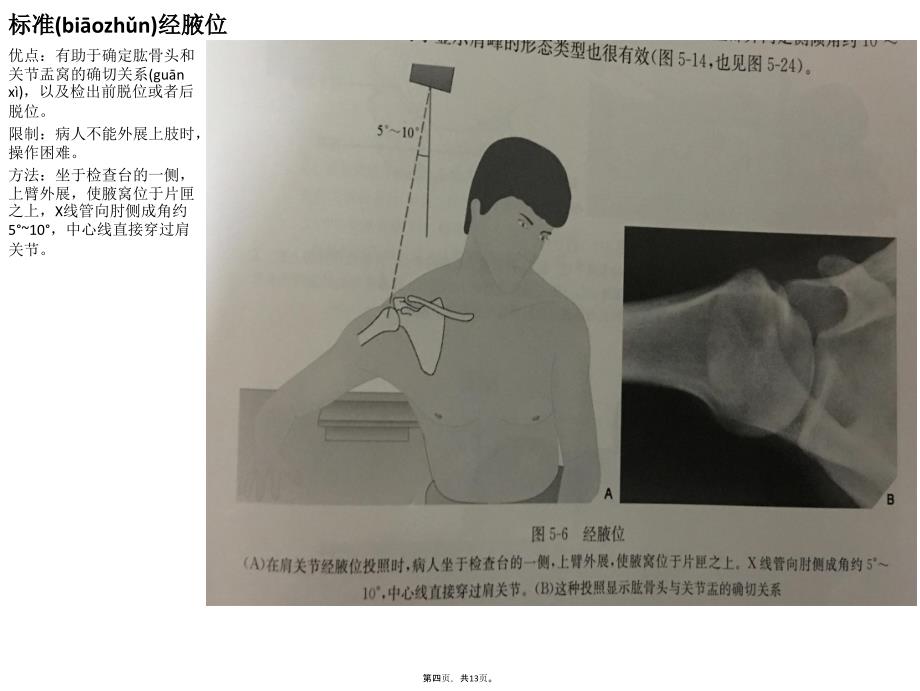 不同肩关节X线投照位资料_第4页