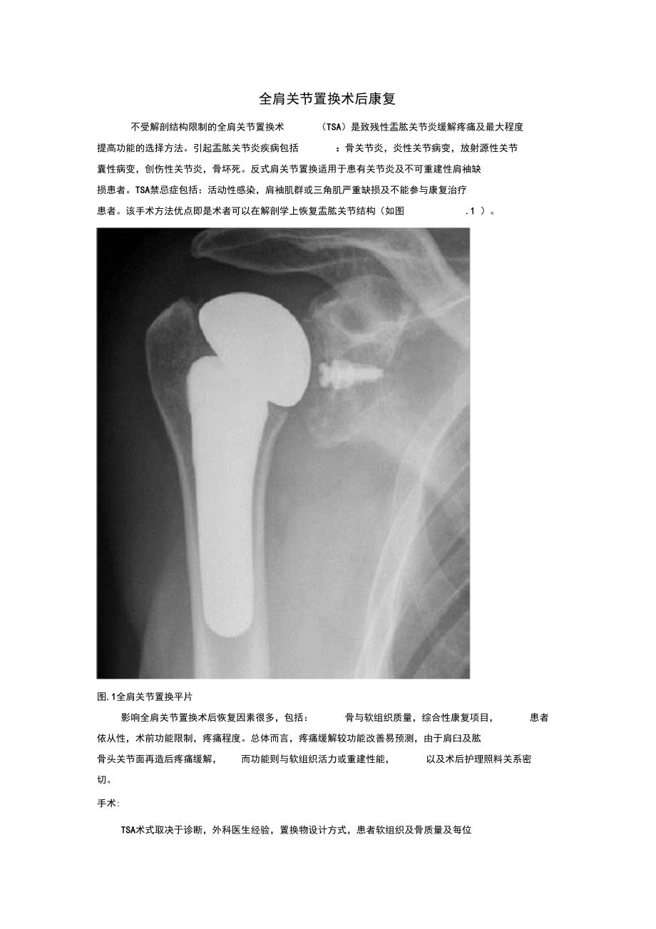 全肩关节置换术后康复_第1页