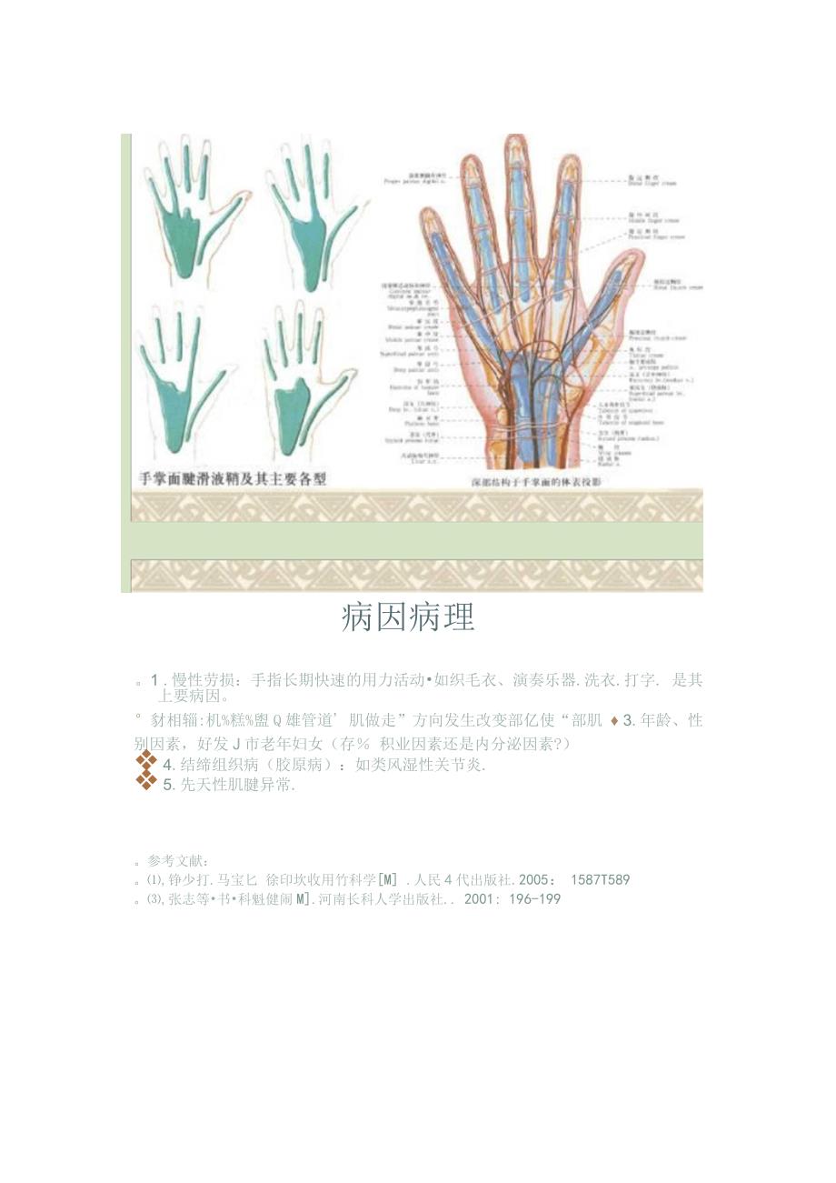 屈指肌狭窄性腱鞘炎解读_第4页