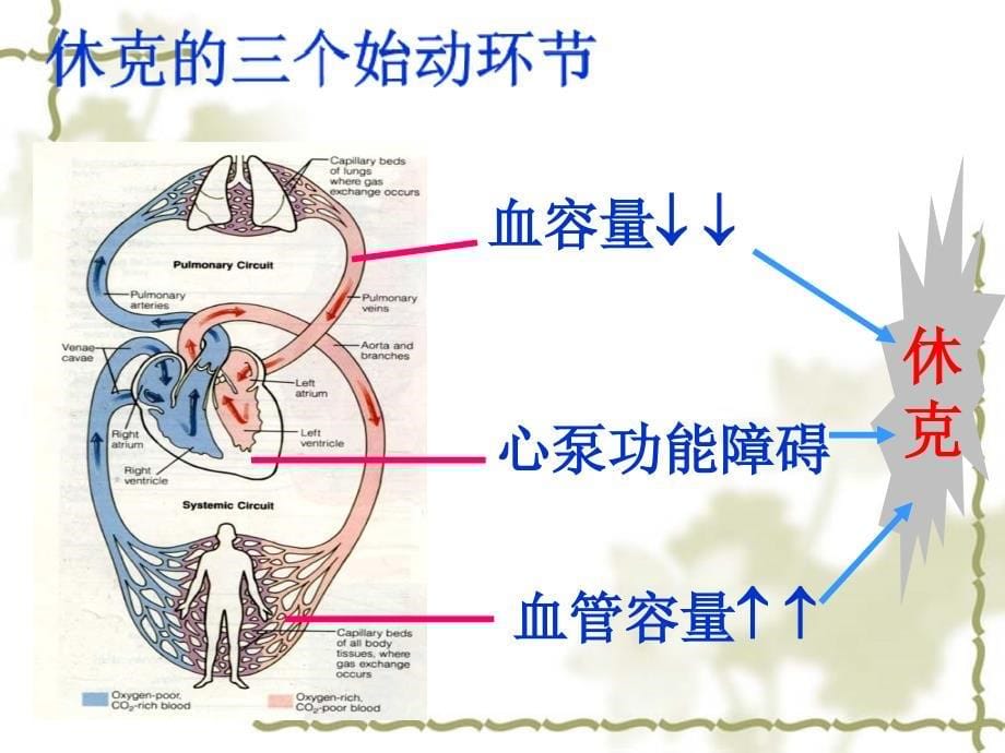 休克的分类及抢救_第5页