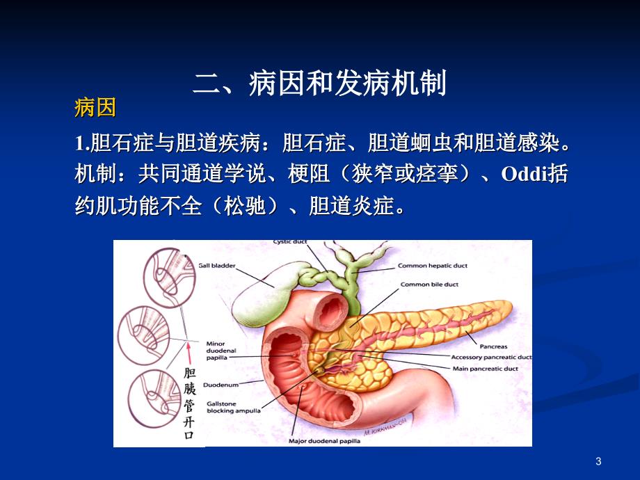 急性胰腺炎教学ppt课件_第3页