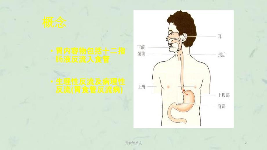 胃食管反流课件_第2页