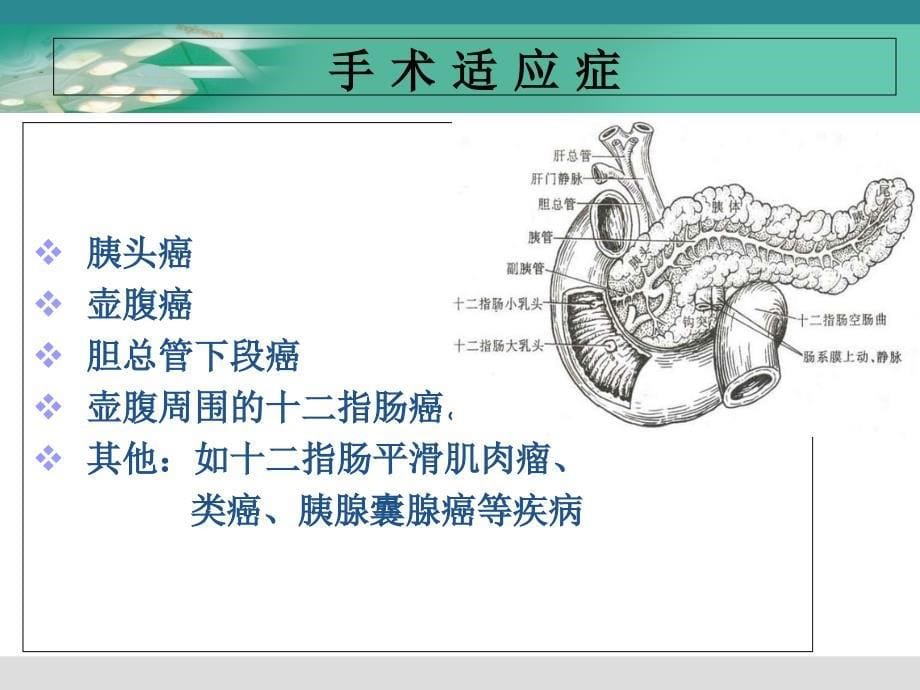 胰十二指肠切除术教学查房1课件_第5页