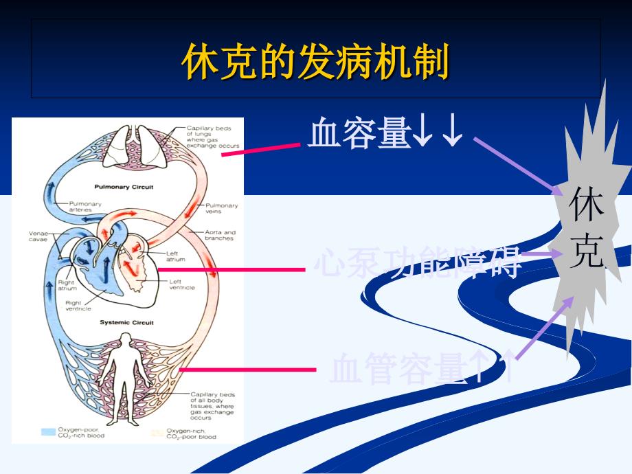 休克的急救护理1课件_第4页