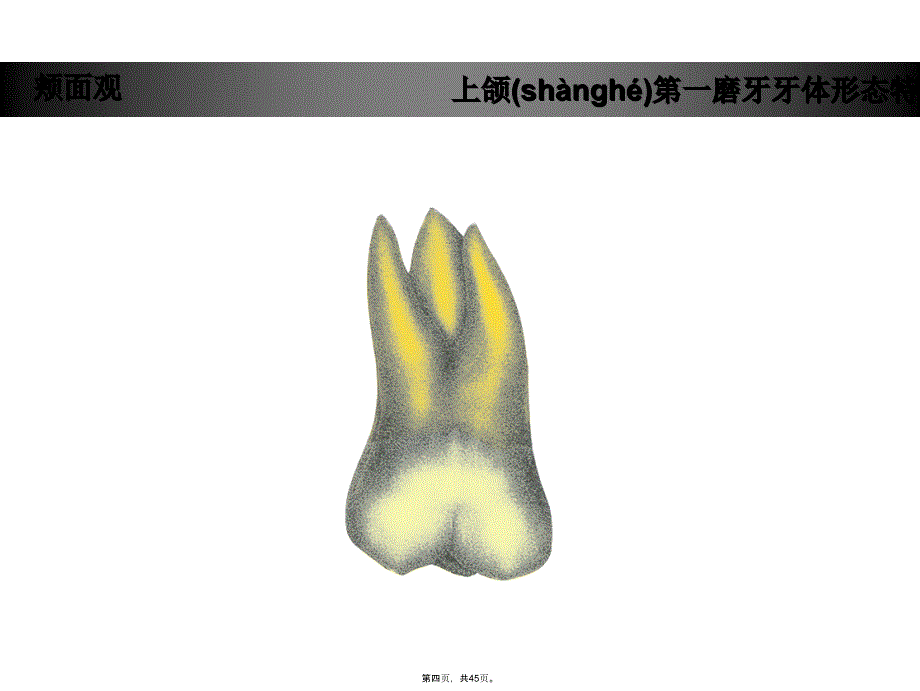 上颌第一磨牙牙体形态简述演示教学_第4页