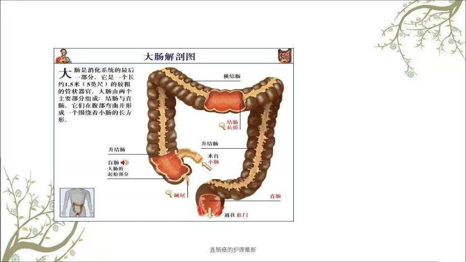 直肠癌的护理最新课件_第2页