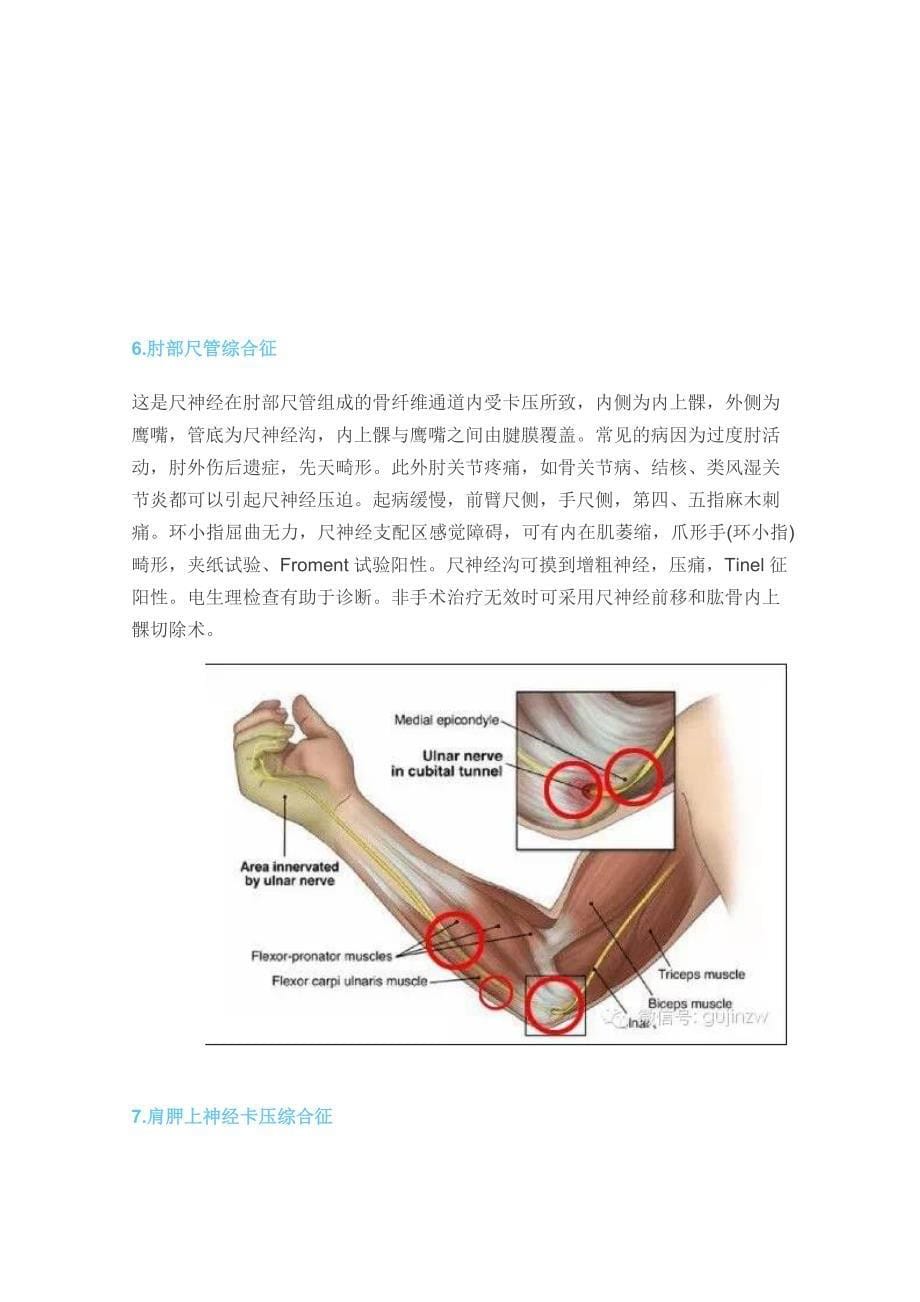 骨科常见12种周围神经卡压综合征_第5页