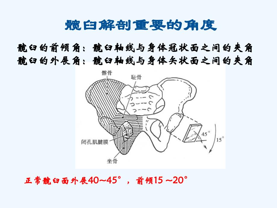 威高髋关节置换手术操作(116页）_第4页