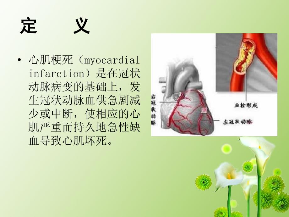 心肌梗死康复护理确定版.ppt_第2页